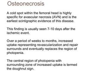 A cold spot within the femoral head is highly
specific for avascular necrosis (AVN) and is the
earliest scintigraphic evidence of this disease.
This finding is usually seen 7-10 days after the
ischemic event.
Over a period of weeks to months, increased
uptake representing revascularization and repair
surrounds and eventually replaces the region of
photopenia.
The central region of photopenia with
surrounding zone of increased uptake is termed
the doughnut sign.
Osteonecrosis
 
