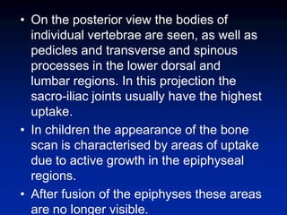 • On the posterior view the bodies of
individual vertebrae are seen, as well as
pedicles and transverse and spinous
processes in the lower dorsal and
lumbar regions. In this projection the
sacro-iliac joints usually have the highest
uptake.
• In children the appearance of the bone
scan is characterised by areas of uptake
due to active growth in the epiphyseal
regions.
• After fusion of the epiphyses these areas
are no longer visible.
 