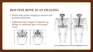 BONE SCINTIGRAPHY.pptx
