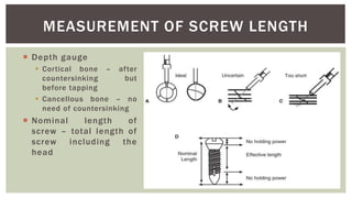 Bone Screw Ruler Bone screws - Principles and biomechanics - Dr. Sachin M | PPTX