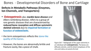 Bones I.pptx
