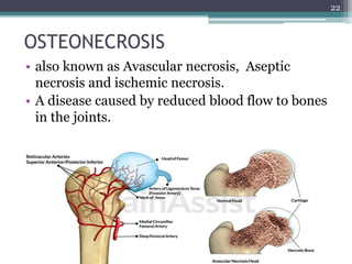 OSTEONECROSIS
• also known as Avascular necrosis, Aseptic
necrosis and ischemic necrosis.
• A disease caused by reduced blood flow to bones
in the joints.
22
 