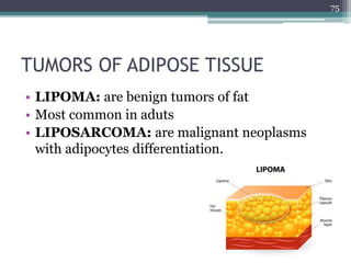 TUMORS OF ADIPOSE TISSUE
• LIPOMA: are benign tumors of fat
• Most common in aduts
• LIPOSARCOMA: are malignant neoplasms
with adipocytes differentiation.
75
 