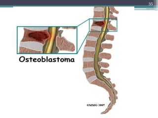 Bones,joints and soft tissue tumors Slide 35