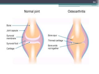 Bones,joints and soft tissue tumors Slide 66