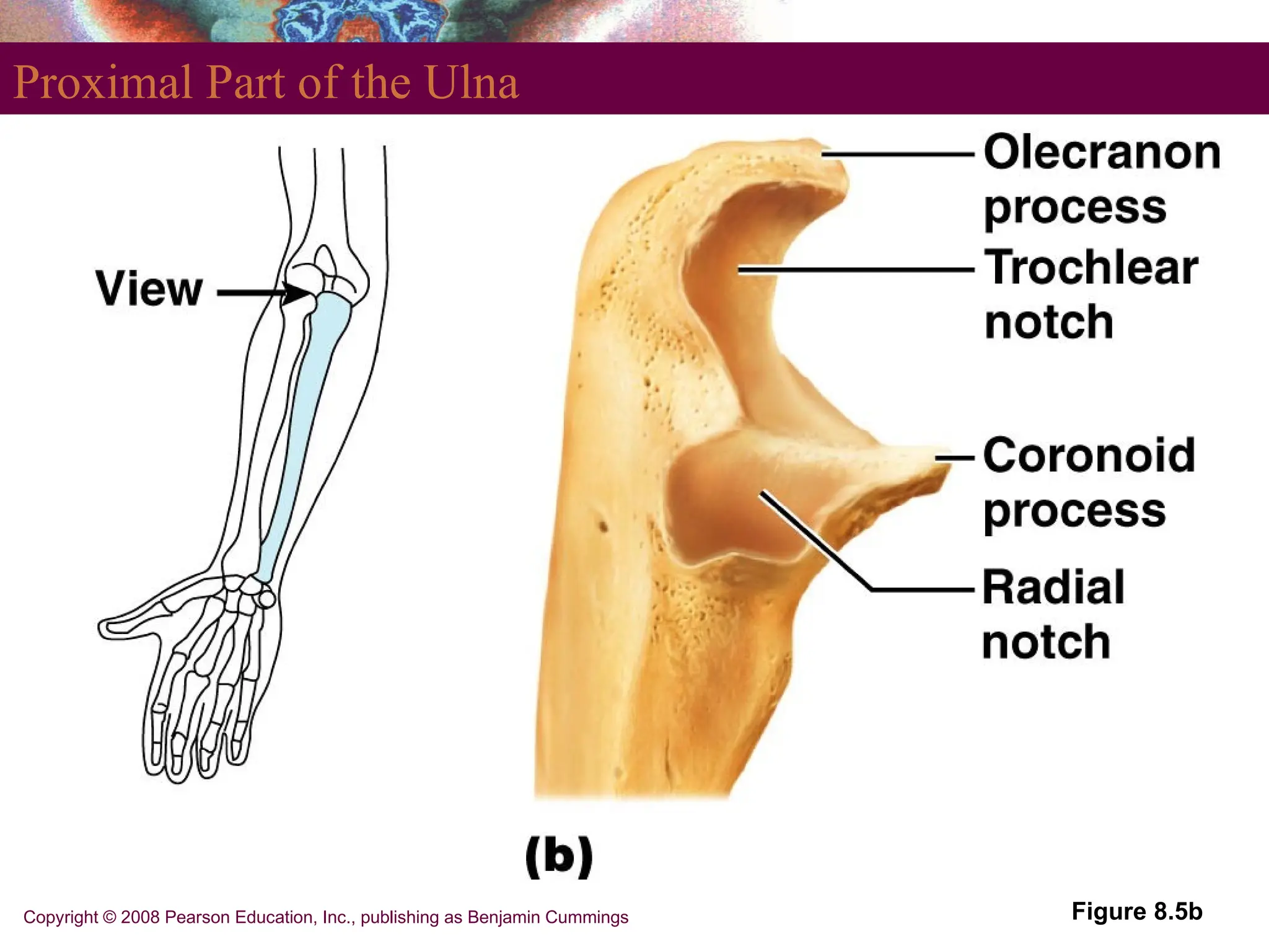 Copyright © 2008 Pearson Education, Inc., publishing as Benjamin Cummings
Proximal Part of the Ulna
Figure 8.5b
 
