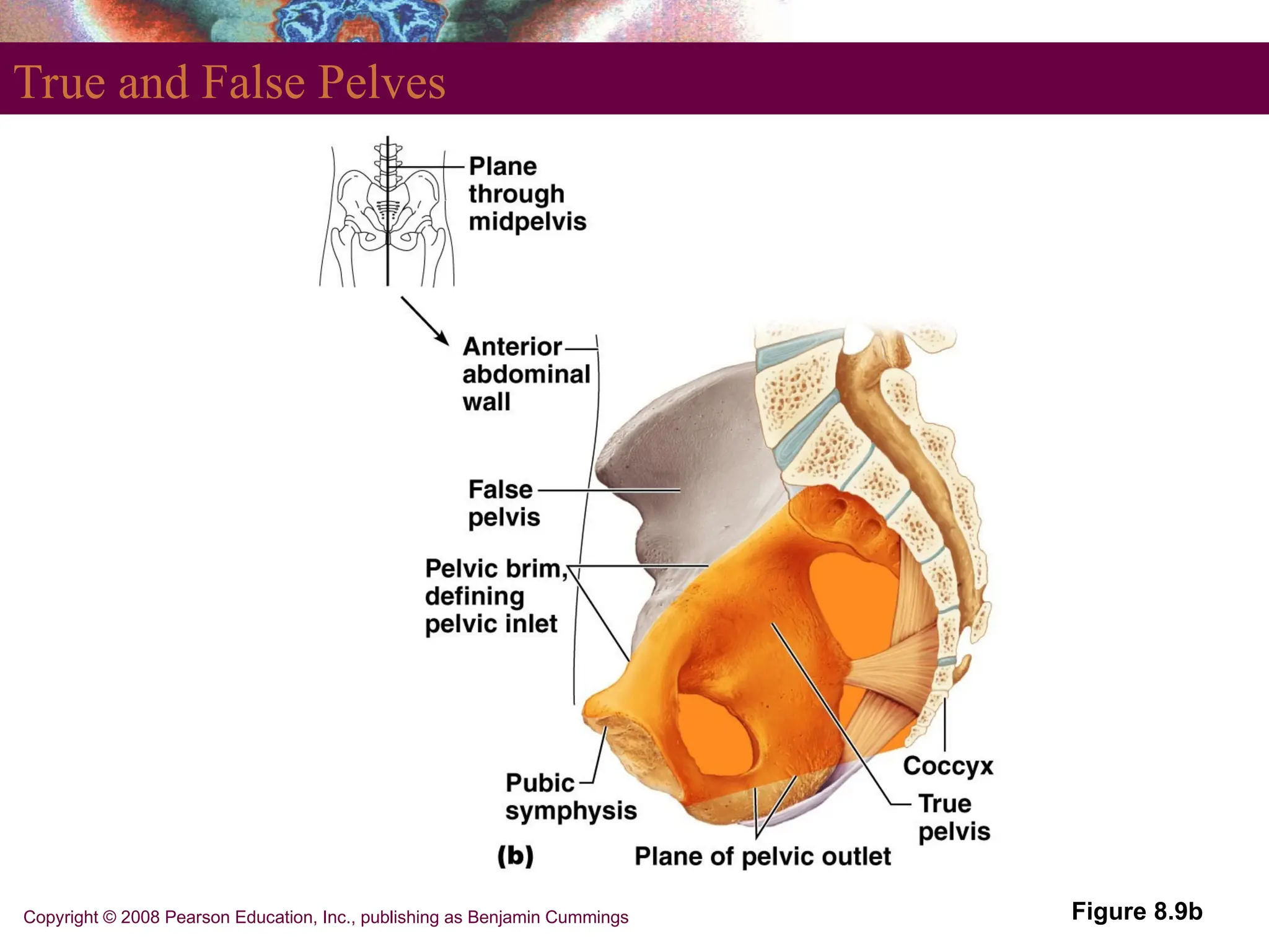 Copyright © 2008 Pearson Education, Inc., publishing as Benjamin Cummings
True and False Pelves
Figure 8.9b
 