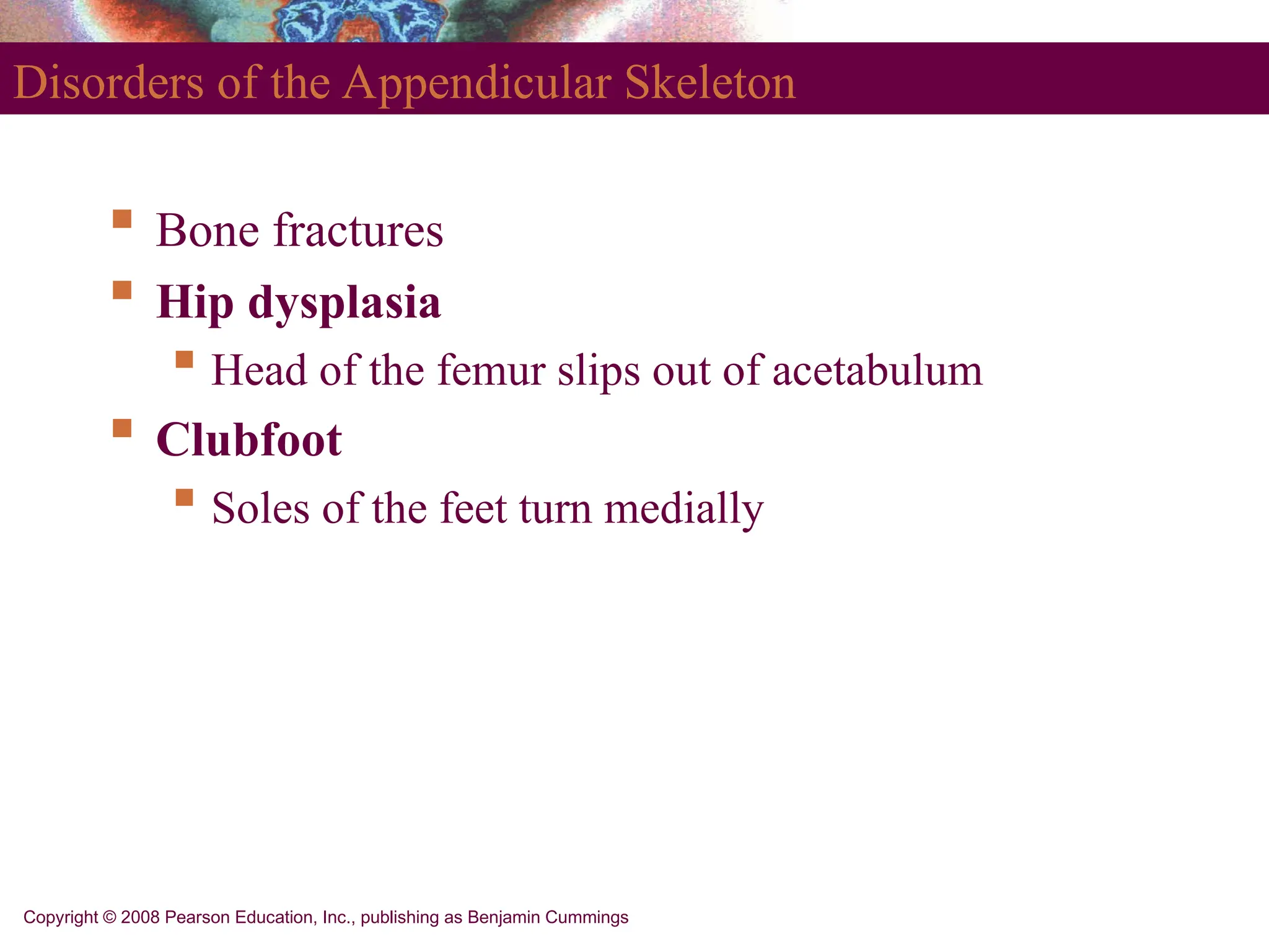 Copyright © 2008 Pearson Education, Inc., publishing as Benjamin Cummings
Disorders of the Appendicular Skeleton
 Bone fractures
 Hip dysplasia
 Head of the femur slips out of acetabulum
 Clubfoot
 Soles of the feet turn medially
 