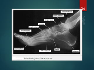 Good Limbs BONES OF LOWER LIMB good anatomy notes .pptx