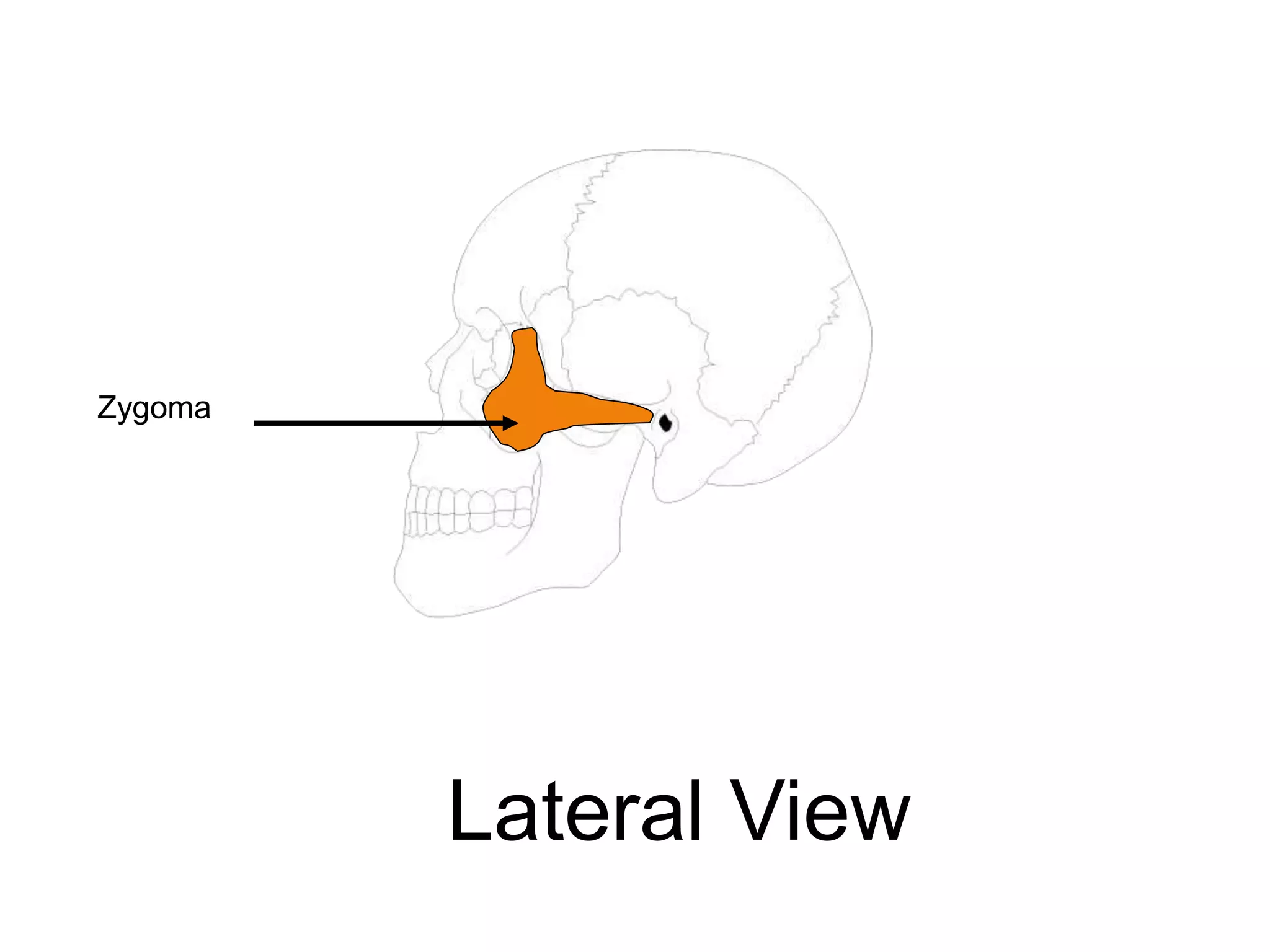 Zygoma
Lateral View
 