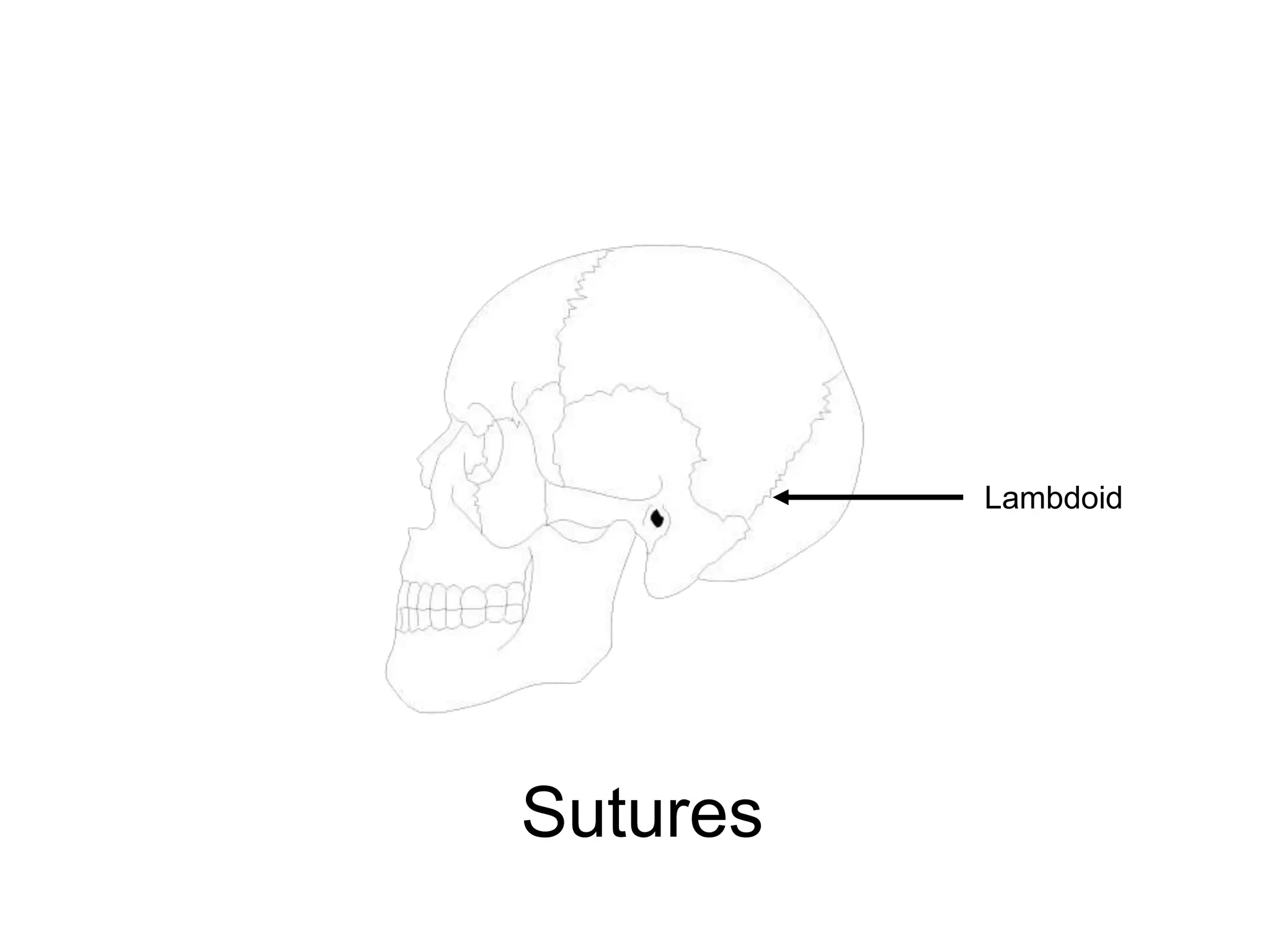 Lambdoid
Sutures
 