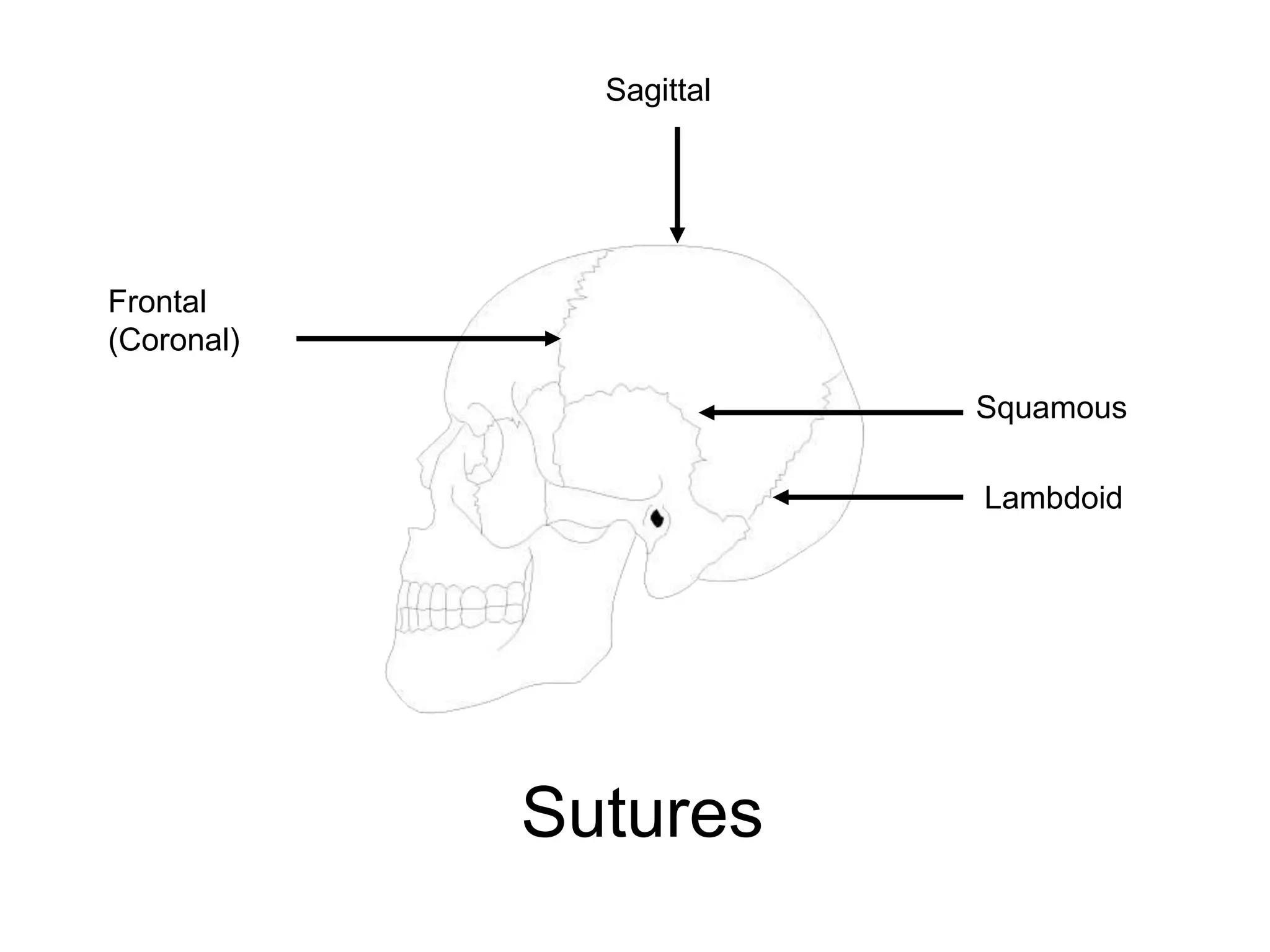 Frontal
(Coronal)
Sagittal
Squamous
Lambdoid
Sutures
 