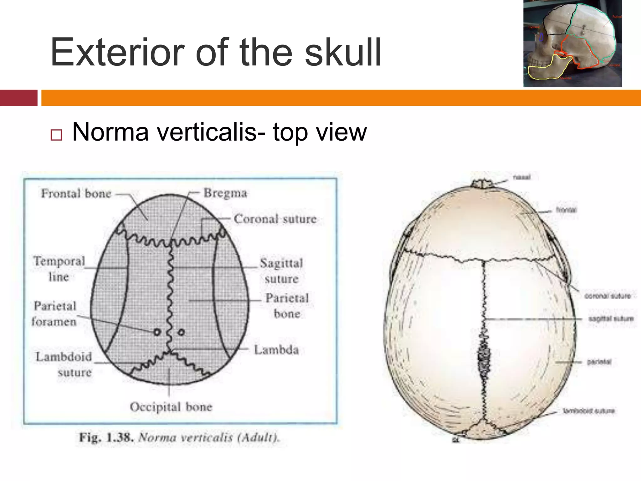 Exterior of the skull
 Norma verticalis- top view
 