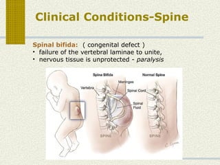 Spinal Defet bonesoftrunk.,trunk, anatomy,,,,,,,,pptx | PPTX