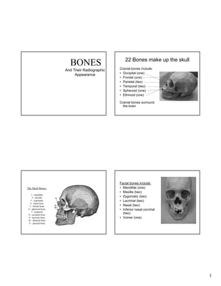 BONES
And Their Radiographic
Appearance

22 Bones make up the skull
Cranial bones include:
• Occipital (one)
• Frontal (one)
• Parietal (two)
• Temporal (two)
• Sphenoid (one)
• Ethmoid (one)
Cranial bones surround
the brain

The Skull Bones:
1 - mandible
2 - maxilla
3 - zygomatic
4 - nasal bone
5 - frontal bone
6 - sphenoid bone
7 - temporal
8 - occipital bone
9 - lacrimal bone
10 - ethmoid bone
11 - parietal bone

Facial bones include:
• Mandible (one)
• Maxilla (two)
• Zygomatic (two)
• Lacrimal (two)
• Nasal (two)
• Inferior nasal conchal
(two)
• Vomer (one)

1

 