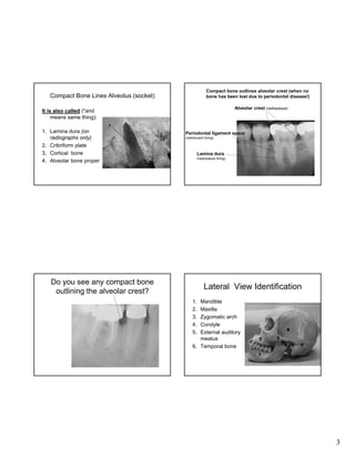 Compact bone outlines alveolar crest (when no
bone has been lost due to periodontal disease!)

Compact Bone Lines Alveolus (socket)

Alveolar crest (radiopaque)

It is also called (*and
means same thing):
1. Lamina dura (on
radiographs only)
2. Cribriform plate
3. Cortical bone
4. Alveolar bone proper

Periodontal ligament space
(radiolucent lining)

Lamina dura
(radiopaque lining)

Do you see any compact bone
outlining the alveolar crest?

Lateral View Identification
1.
2.
3.
4.
5.

Mandible
Maxilla
Zygomatic arch
Condyle
External auditory
meatus
6. Temporal bone

3

 