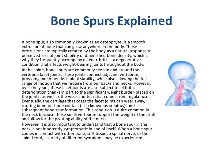 What are bone spurs in the neck?