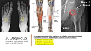 Συμπέρασμα
Tim Hoenig, Julian Eissele, André
Strahl et al. (2023-01-31)
Τα κατάγματα κοπώσεως (BSIs) συνδέονται με αυξημένα ποσοστά επιπλοκών και
δυσκολότερη επιστροφή στη άσκηση στις παρακάτω ανατομικές θέσεις :
• 1. Οστά του ταρσού του ποδός
• 2. Πρόσθιος κνημιαίος άξονας
• 3. Αυχένας του μηριαίου οστού
 