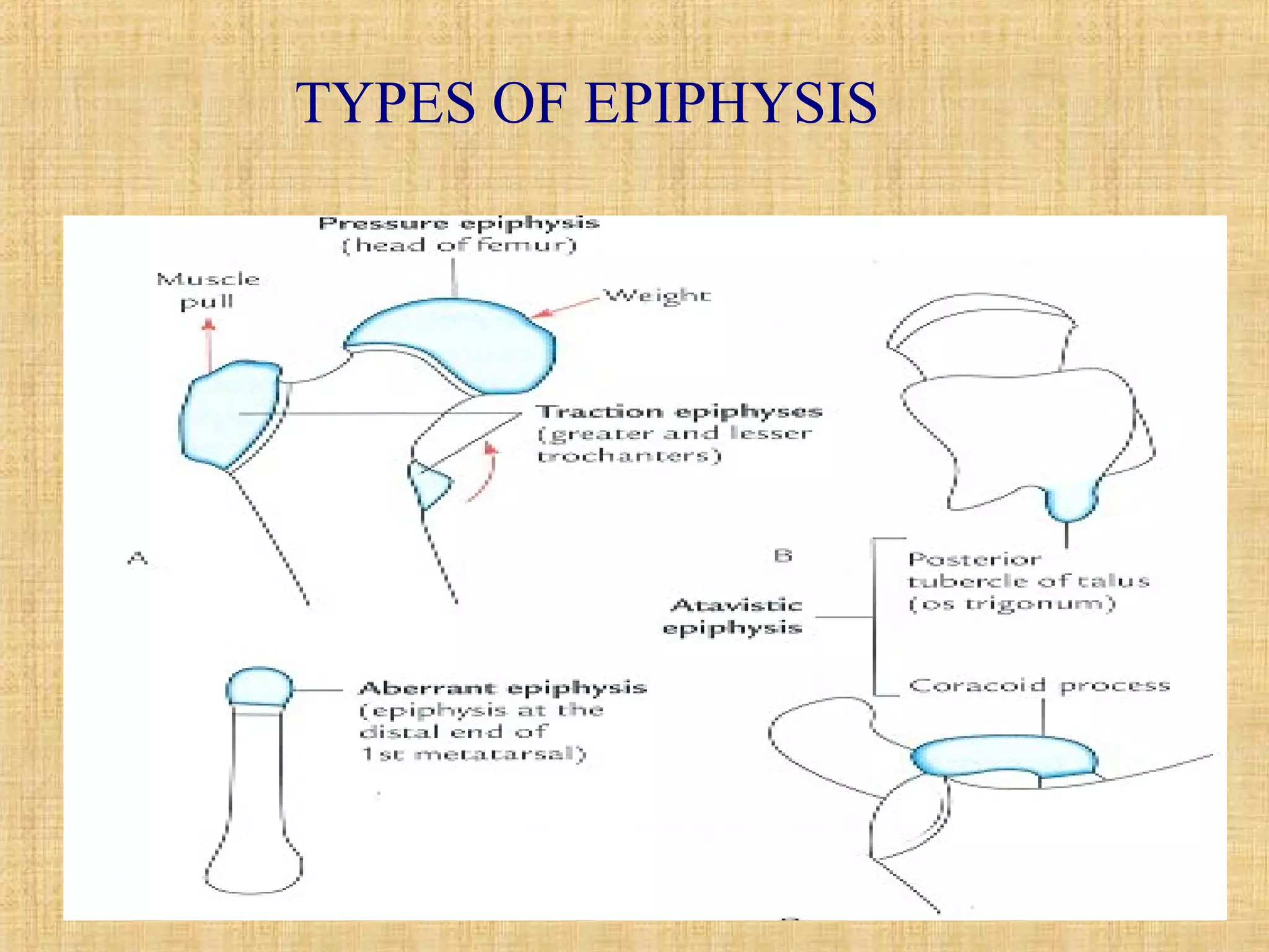 TYPES OF EPIPHYSIS 
 