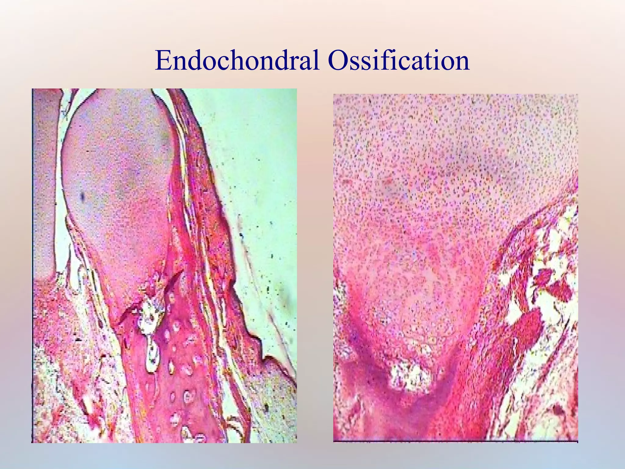 Endochondral Ossification 
 