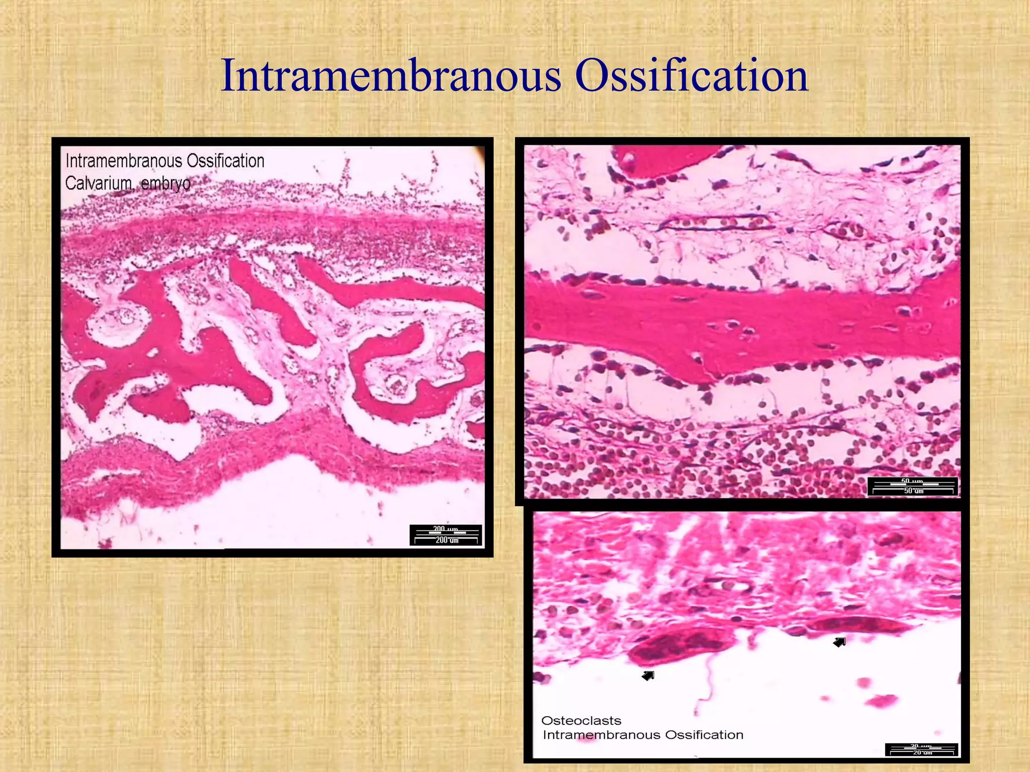 Intramembranous Ossification 
 