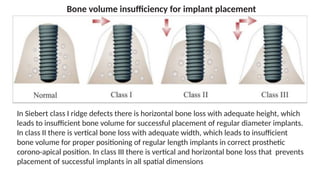 Siberet Ridge Defect BONE SUBSTITUTES IN HARD TISSUE REHABILITATION AROUND IMPLANTS_final.pptx