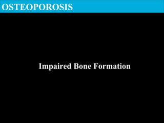 OSTEOPOROSIS
Impaired Bone Formation
 