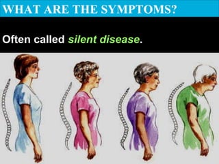 WHAT ARE THE SYMPTOMS?
Often called silent disease.
 