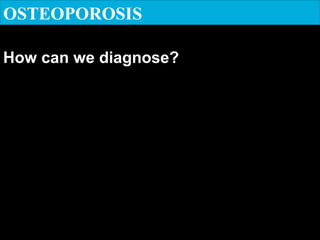 OSTEOPOROSIS
How can we diagnose?
 
