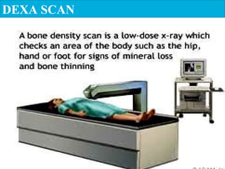 DEXA SCAN
 