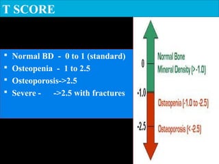  Normal BD - 0 to 1 (standard)
 Osteopenia - 1 to 2.5
 Osteoporosis->2.5
 Severe - ->2.5 with fractures
T SCORE
 