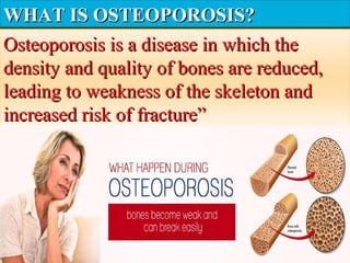 WHAT IS OSTEOPOROSIS?WHAT IS OSTEOPOROSIS?
Osteoporosis is a disease in which theOsteoporosis is a disease in which the
density and quality of bones are reduced,density and quality of bones are reduced,
leading to weakness of the skeleton andleading to weakness of the skeleton and
increased risk of fracture”increased risk of fracture”
 