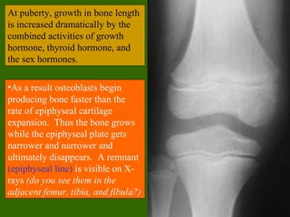 At puberty, growth in bone length
is increased dramatically by the
combined activities of growth
hormone, thyroid hormone, and
the sex hormones.

•As a result osteoblasts begin
producing bone faster than the
rate of epiphyseal cartilage
expansion. Thus the bone grows
while the epiphyseal plate gets
narrower and narrower and
ultimately disappears. A remnant
(epiphyseal line) is visible on X-
rays (do you see them in the
adjacent femur, tibia, and fibula?)
 