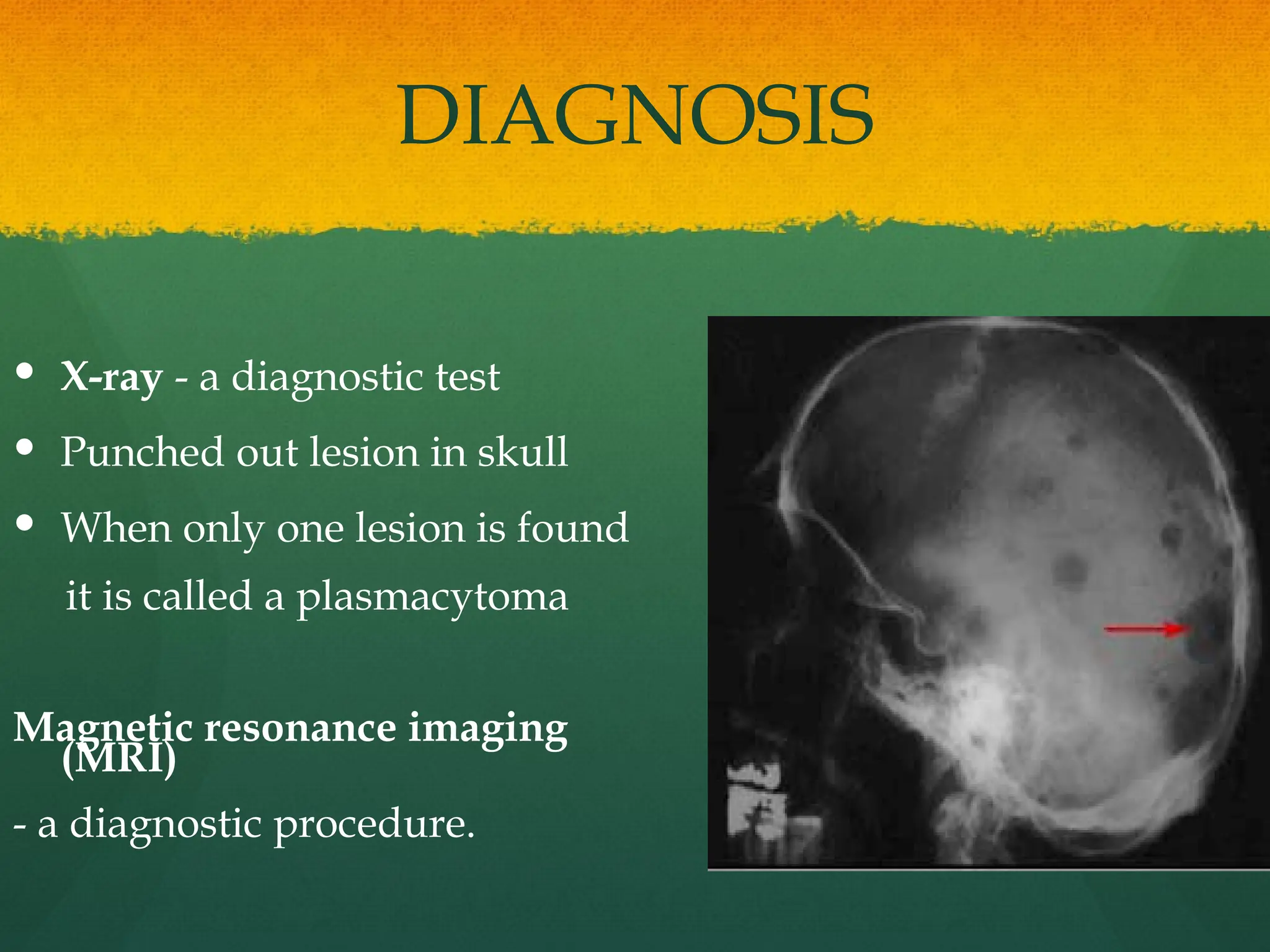 DIAGNOSIS
 X-ray - a diagnostic test
 Punched out lesion in skull
 When only one lesion is found
it is called a plasmacytoma
Magnetic resonance imaging
(MRI)
- a diagnostic procedure.
 