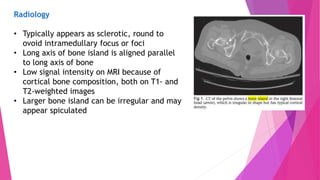Bone Tumor | PPTX