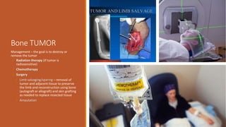 Bone TUMOR
Management – the goal is to destroy or
remove the tumor
§ Radiation therapy (if tumor is
radiosensitive)
§ Chemotherapy
§ Surgery
§ Limb-salvaging/sparing – removal of
tumor and adjacent tissue to preserve
the limb and reconstruction using bone
(autograft or allograft) and skin grafting
as needed to replace resected tissue
§ Amputation