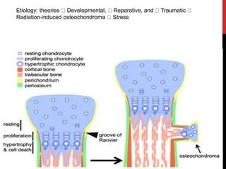 Etiology: theories Developmental, Reparative, and Traumatic
Radiation-induced osteochondroma Stress
 