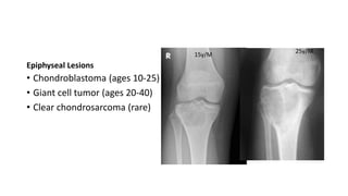 Epiphyseal Lesions
• Chondroblastoma (ages 10-25)
• Giant cell tumor (ages 20-40)
• Clear chondrosarcoma (rare)
15y/M
25y/M
 