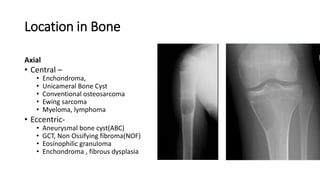 Location in Bone
Axial
• Central –
• Enchondroma,
• Unicameral Bone Cyst
• Conventional osteosarcoma
• Ewing sarcoma
• Myeloma, lymphoma
• Eccentric-
• Aneurysmal bone cyst(ABC)
• GCT, Non Ossifying fibroma(NOF)
• Eosinophilic granuloma
• Enchondroma , fibrous dysplasia
 