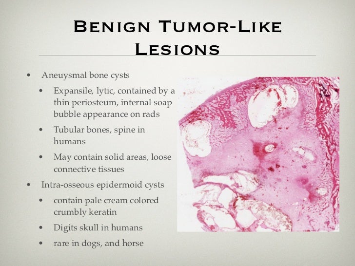 Musculoskeletal tumors