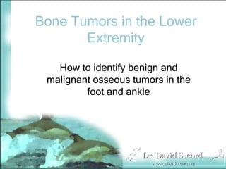 Bone Tumors in the Lower
       Extremity

   How to identify benign and
 malignant osseous tumors in the
         foot and ankle
 