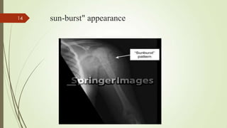 sun-burst" appearance14
 