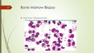 Bone Marrow Biopsy
 More than 10% plasma cells
57
 