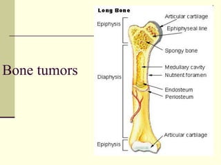 Bone tumors
 