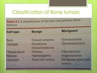 Classification of Bone tumors
 