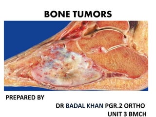BONE TUMORS
PREPARED BY
DR BADAL KHAN PGR.2 ORTHO
UNIT 3 BMCH
 