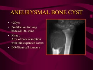 Bone_tumors.ppt