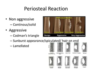 Bone tumors.pptx