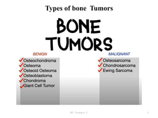 Types of bone Tumors
BY Yordanos L 5
 