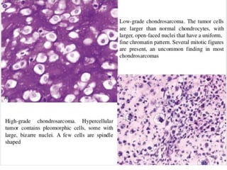 Radiological and pathological correlation of bone tumours Dr.Argha ...
